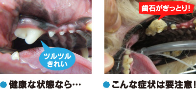 健康な状態ならツルツルきれい。　こんな状態は要注意！歯石がぎっしり！