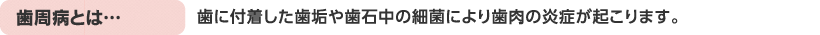 歯周病とは…歯に付着した歯垢や歯石中の細菌により歯肉の炎症が起こります。